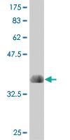 Anti-BOLL Mouse Monoclonal Antibody [clone: 1G8]