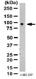 Anti-HELLS Rabbit Polyclonal Antibody