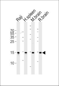 Anti-FIS1 Rabbit Polyclonal Antibody