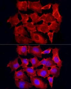 Immunofluorescence analysis of HeLa cells using Anti-TRAF6 Antibody (A12731) at a dilution of 1:100 (40X lens). DAPI was used to stain the cell nuclei (blue)