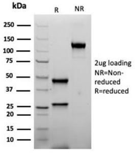 SDS-PAGE analysis of Anti-Inhibin alpha Antibody [rINHA/6919] under non-reduced and reduced conditions; showing intact IgG and intact heavy and light chains, respectively. SDS-PAGE analysis confirms the integrity and purity of the Antibody