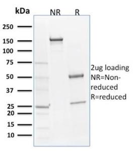 Anti-SOX9 antibody