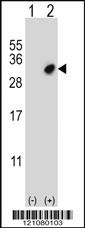 Anti-GSTO2 Rabbit Polyclonal Antibody