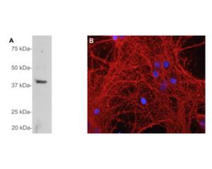 A: Western blot analysis of GAP43 expression in cow cerebellum. R-1651-100 detects a single band at ~43 kDa, which corresponds to full-length GAP43 protein.<br />B: Immunofluorescence analysis of mixed neuron-glia cultures with GAP43 rabbit antibody R-1651-100 (red). DNA is stained blue.