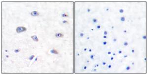 Anti-BACE antibody