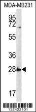 Anti-SYPL1 Rabbit Polyclonal Antibody