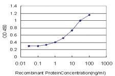 Anti-FOXO3 Mouse Monoclonal Antibody [clone: 3C2]