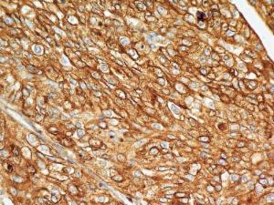 Anti-BST2 Mouse Monoclonal Antibody [clone: 4F6]