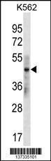 Anti-KRT33B Rabbit Polyclonal Antibody (HRP (Horseradish Peroxidase))