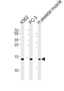 Anti-HIST1H2BM Rabbit Polyclonal Antibody