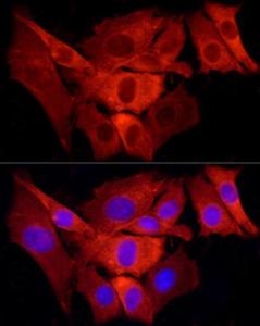 Immunofluorescence analysis of NIH/3T3 cells using Anti-TRAF6 Antibody (A12731) at a dilution of 1:100 (40X lens). DAPI was used to stain the cell nuclei (blue)