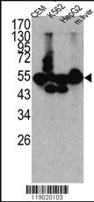 Anti-CPN1 Rabbit Polyclonal Antibody