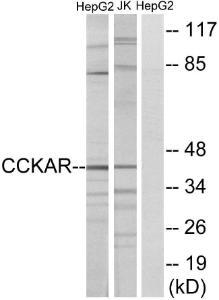 Western blot analysis of lysates from HepG2 and Jurkat cells using Anti-CCKAR Antibody The right hand lane represents a negative control, where the antibody is blocked by the immunising peptide