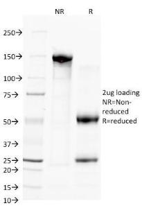 SDS-PAGE analysis of Anti-CD38 Antibody [FS02] under non-reduced and reduced conditions; showing intact IgG and intact heavy and light chains, respectively. SDS-PAGE analysis confirms the integrity and purity of the antibody