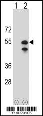 Anti-CPN1 Rabbit Polyclonal Antibody