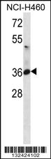 Anti-ATP1B3 Rabbit Polyclonal Antibody