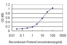 Anti-ZAP70 Mouse Monoclonal Antibody [clone: 2F6]