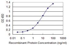 Anti-QPCT Mouse Monoclonal Antibody [clone: 3G2]