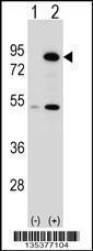 Anti-THOC1 Rabbit Polyclonal Antibody (Biotin)