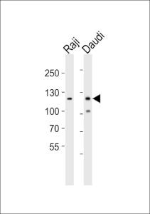 Anti-PTK2B Rabbit Polyclonal Antibody