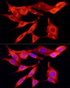 Immunofluorescence analysis of PC-12 cells using Anti-TRAF6 Antibody (A12731) at a dilution of 1:100 (40X lens). DAPI was used to stain the cell nuclei (blue)