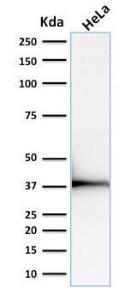 Western blot analysis of human HeLa cell lysate using Anti-Emerin Antibody [EMD/2168]