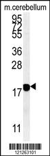 Anti-SLC15A3 Rabbit Polyclonal Antibody