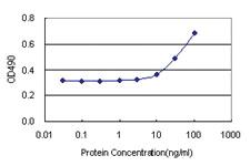 Anti-RP2 Antibody Pair