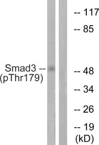 Western blot analysis of lysates from HeLa cells treated with TNF 20ng/ml 2' using Anti-Smad3 (phospho Thr179) Antibody. The right hand lane represents a negative control, where the antibody is blocked by the immunising peptide