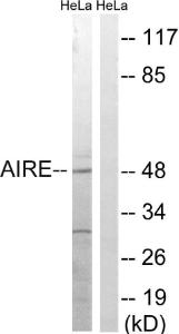 Western blot analysis of lysates from HeLa cells, treated with Hu 2 nM 24 h using Anti-AIRE Antibody. The right hand lane represents a negative control, where the Antibody is blocked by the immunising peptide