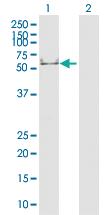 Anti-CK16 Rabbit Polyclonal Antibody