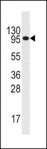 Anti-IL3R Rabbit Polyclonal Antibody (HRP (Horseradish Peroxidase))