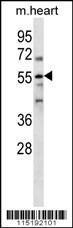 Anti-PARP2 Rabbit Polyclonal Antibody (HRP (Horseradish Peroxidase))