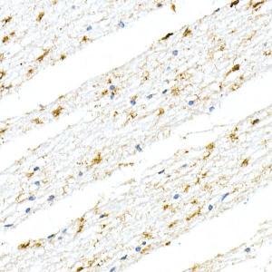 Anti-GFAP Rabbit Monoclonal Antibody [clone: ARC0206]