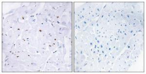 Immunohistochemical analysis of paraffin-embedded human heart using Anti-Smad3 (phospho Thr179) Antibody. The right hand panel represents a negative control, where the antibody was pre-incubated with the immunising peptide