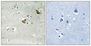 Immunohistochemical analysis of paraffin-embedded human brain using Anti-CCKAR Antibody 1:100 (4°C overnight) The right hand panel represents a negative control, where the antibody was pre-incubated with the immunising peptide