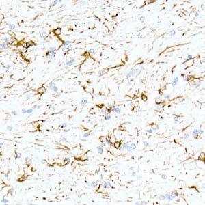 Anti-GFAP Rabbit Monoclonal Antibody [clone: ARC0206]