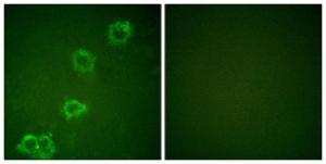 Anti-BACE antibody