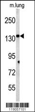 Anti-CP Rabbit Polyclonal Antibody