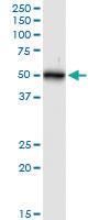 Anti-CK16 Rabbit Polyclonal Antibody