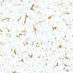 Anti-GFAP Rabbit Monoclonal Antibody [clone: ARC0206]