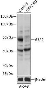 Western blot analysis of extracts from normal (control) and GBP2 knockout (KO) A-549 cells, using Anti-GBP2 Antibody (A308296) at 1:1,000 dilution. The secondary antibody was Goat Anti-Rabbit IgG H&L Antibody (HRP) at 1:10,000 dilution.