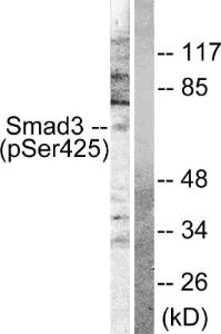 Western blot analysis of lysates from NIH/3T3 cells treated with IGF-I 100ng/ml 10' using Anti-Smad3 (phospho Ser425) Antibody. The right hand lane represents a negative control, where the antibody is blocked by the immunising peptide.