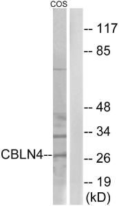 Western blot analysis of lysates from COS cells using Anti-CBLN4 Antibody The right hand lane represents a negative control, where the antibody is blocked by the immunising peptide