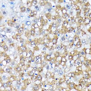 Immunohistochemistry analysis of paraffin-embedded rat liver using Anti-Casein Kinase 1 alpha Antibody [ARC1860] (A305735) at a dilution of 1:100 (40x lens). Perform microwave antigen retrieval with 10 mM Tris/EDTA buffer pH 9.0 before commencing with IHC staining protocol.