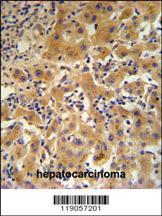 Anti-CP Rabbit Polyclonal Antibody