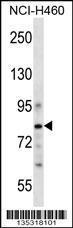 Anti-CDCP1 Rabbit Polyclonal Antibody (HRP (Horseradish Peroxidase))