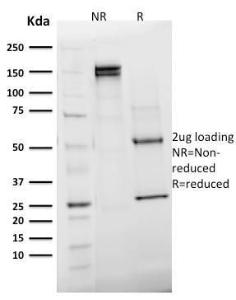 SDS-PAGE analysis of Anti-Emerin Antibody [EMD/2168] under non-reduced and reduced conditions; showing intact IgG and intact heavy and light chains, respectively SDS-PAGE analysis confirms the integrity and purity of the antibody