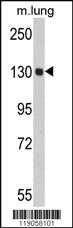 Anti-SF3B1 Rabbit Polyclonal Antibody