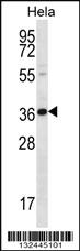 Anti-BTG3 Rabbit Polyclonal Antibody